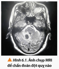 Để chẩn đoán những bất thường của não (Hình 6.1) và tuỷ sống; các bệnh liên quan đến tim mạch