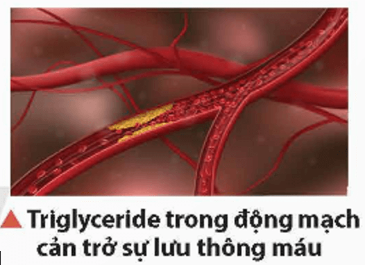 Triglyceride (chất béo) thuộc loại ester, là một lipid có trong cơ thể người