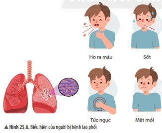 Lý thuyết Khoa học tự nhiên 6 Bài 25: Vi khuẩn | Chân trời sáng tạo