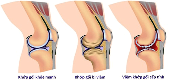 Lý thuyết KHTN 8 Cánh diều Bài 28: Hệ vận động ở người