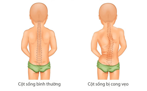 Lý thuyết KHTN 8 Cánh diều Bài 28: Hệ vận động ở người