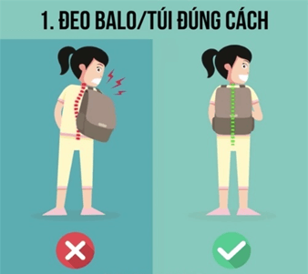 Lý thuyết KHTN 8 Cánh diều Bài 28: Hệ vận động ở người