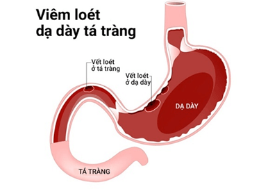 Lý thuyết KHTN 8 Cánh diều Bài 29: Dinh dưỡng và tiêu hóa ở người