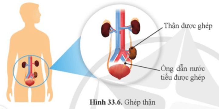 Lý thuyết KHTN 8 Cánh diều Bài 33: Môi trường trong cơ thể và hệ bài tiết ở người