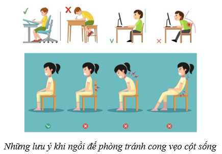 Lý thuyết KHTN 8 Kết nối tri thức Bài 31: Hệ vận động ở người 