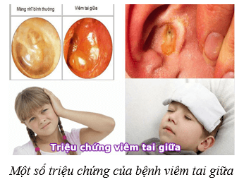 Lý thuyết KHTN 8 Kết nối tri thức Bài 37: Hệ thần kinh và các giác quan ở người 