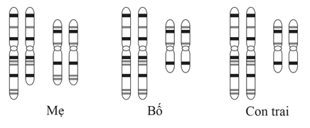 Phân tích bộ nhiễm sắc thể của cặp bố, mẹ và con trai thu được kết quả