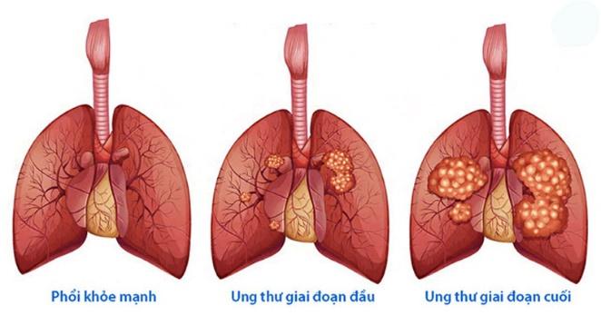 Lý thuyết Sinh 10 Bài 18: Chu kỳ tế bào - Chân trời sáng tạo