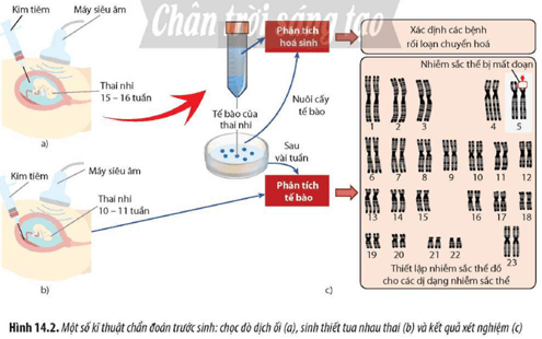 Quan sát Hình 14.2, hãy cho biết tại sao sử dụng kĩ thuật chẩn đoán trước sinh