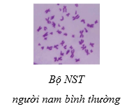 Sinh 12 Kết nối tri thức Bài 14: Thực hành: Quan sát một số dạng đột biến nhiễm sắc thể | Giải Sinh học 12