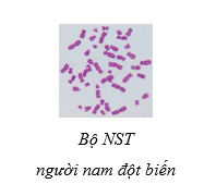 Sinh 12 Kết nối tri thức Bài 14: Thực hành: Quan sát một số dạng đột biến nhiễm sắc thể | Giải Sinh học 12