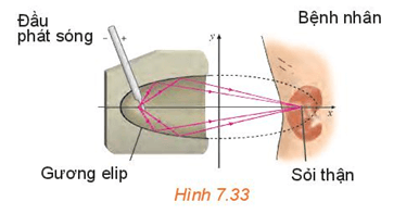 Làm thế nào để tính phương trình chính tắc của gương elip trong máy tán sỏi thận?
